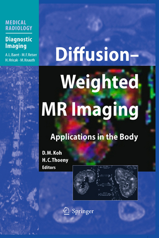 Diffusion-Weighted MR Imaging - D.-M. Koh; Dow-Mu Koh; Harriet C. Thoeny