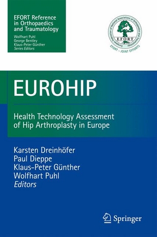 EUROHIP - Wolfhart Puhl; Karsten E. Dreinhöfer; Klaus-Peter Günther; Paul Dieppe; Paul Dieppe; Klaus-Peter Günther; Wolfhart Puhl; Karsten E. Dreinhöfer