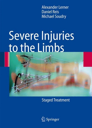 Severe Injuries to the Limbs - Alexander Lerner; Daniel Reis; Michael Soudry