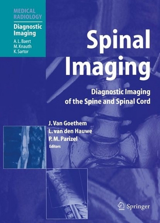 Spinal Imaging - Johan W.M. van Goethem; Luc van den Hauwe; Paul M. Parizel