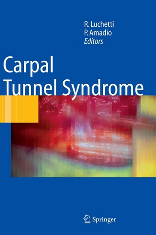 Carpal Tunnel Syndrome - Riccardo Luchetti; Peter Amadio