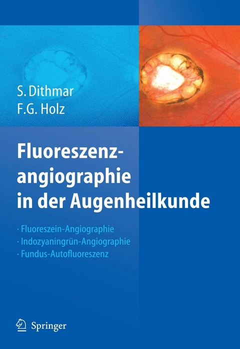 Fluoreszenzangiographie in der Augenheilkunde -  Stefan Dithmar,  Frank G. Holz
