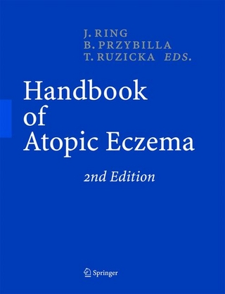 Handbook of Atopic Eczema - Johannes Ring; Bernhard Przybilla; Thomas Ruzicka