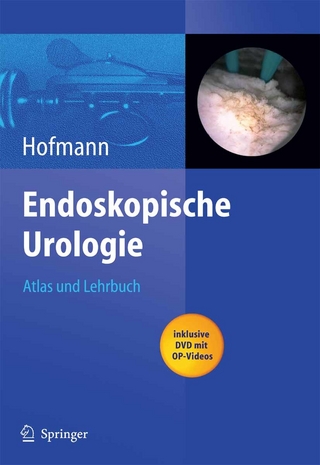 Endoskopische Urologie - Rainer Hofmann