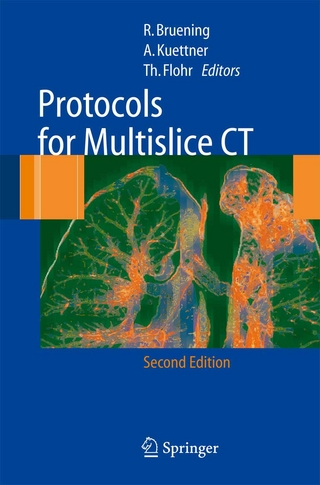 Protocols for Multislice CT - R. Brüning; A. Küttner; T. Flohr