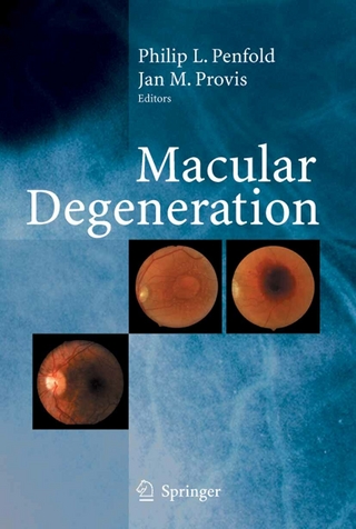 Macular Degeneration - Philip L. Penfold; Philip L. Penfold; Jan M. Provis; Jan M. Provis