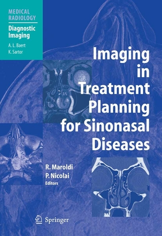 Imaging in Treatment Planning for Sinonasal Diseases - Roberto Maroldi; Piero Nicolai