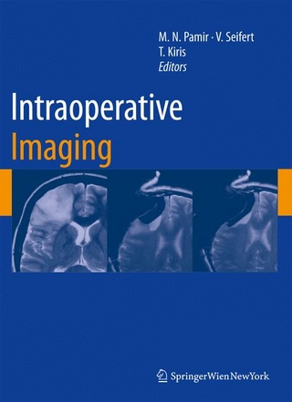 Intraoperative Imaging - M. Necmettin Pamir; Volker Seifert; Talat Kiris