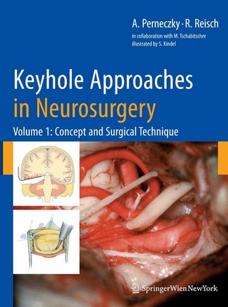 Keyhole Approaches in Neurosurgery - Axel Perneczky; Robert Reisch