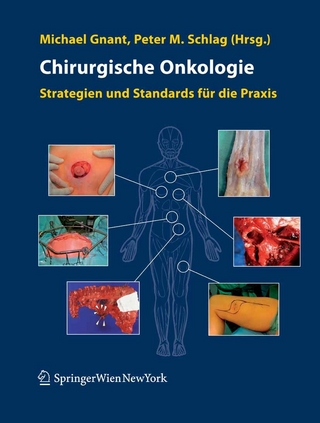 Chirurgische Onkologie - Michael Gnant; Michael Gnant; Peter M. Schlag; Peter M. Schlag.
