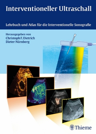 Interventioneller Ultraschall - Christoph Frank Dietrich; Christoph Frank Dietrich; Dieter Nürnberg; Dieter Nürnberg