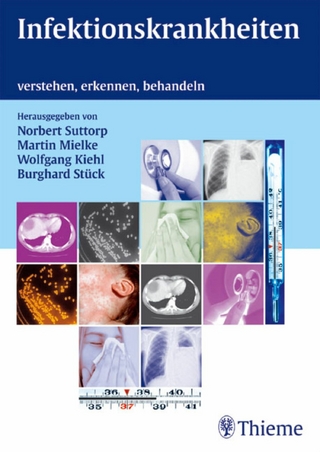 Infektionskrankheiten - Norbert Suttorp; Martin Mielke; Wolfgang Kiehl; Burghard Stück