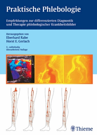 Praktische Phlebologie - Eberhard Rabe; Horst Gerlach