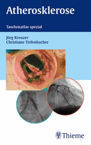 Atherosklerose - Jörg Kreuzer; Christiane Tiefenbacher