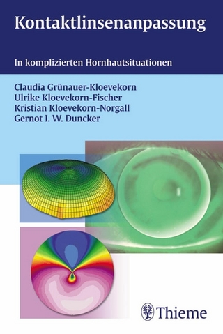Kontaktlinsenanpassung - Claudia Grünauer-Kloevekorn; Ulrike Kloevekorn-Fischer; Kristian Kloevekorn-Norgall; Gernot I. W. Du