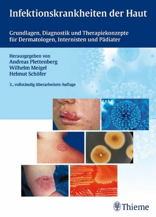 Infektionskrankheiten der Haut - Wilhelm Meigel; Andreas Plettenberg; Helmut Schöfer