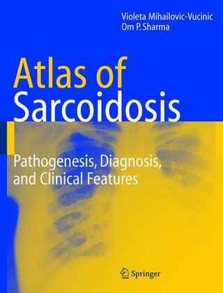 Atlas of Sarcoidosis - Violeta Mihailovic-Vucinic; Om P. Sharma