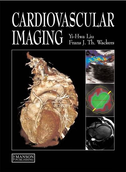 Cardiovascular Imaging -  Yi-Hwa Liu,  Frans Wackers