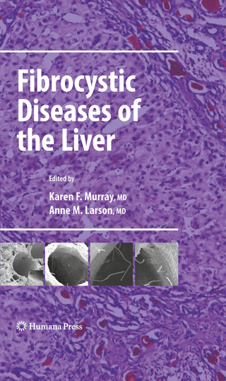Fibrocystic Diseases of the Liver - Karen F. Murray; Karen F. Murray; Anne M. Larson; Anne M. Larson