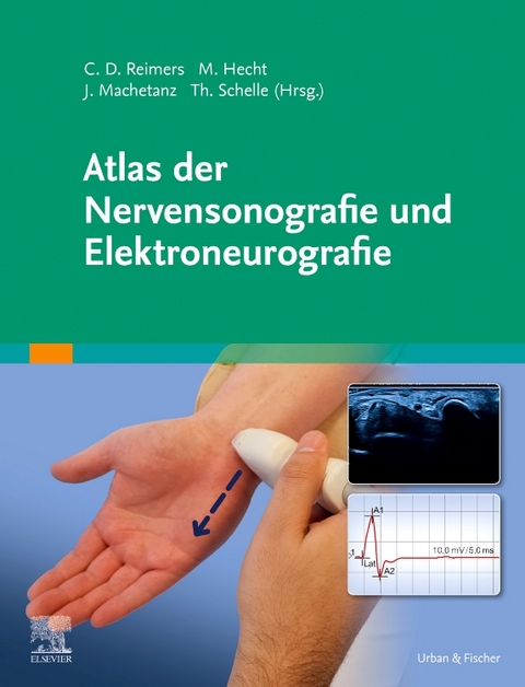 Atlas der Nervensonografie und Elektroneurografie - 