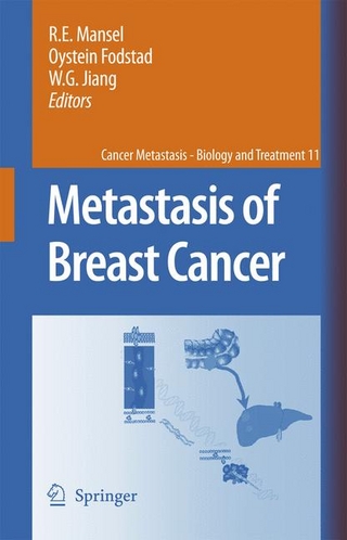 Metastasis of Breast Cancer - Robert E. Mansel; R.E. Mansel; Oystein Fodstad; Oystein Fodstad; Wen G. Jiang; Wen G. Jiang